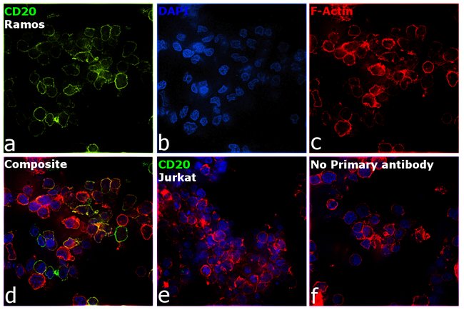 1 ML CD20, Rabbit Monoclonal Antibody Ig