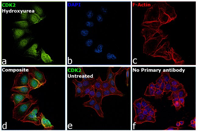 Anti-CDK2