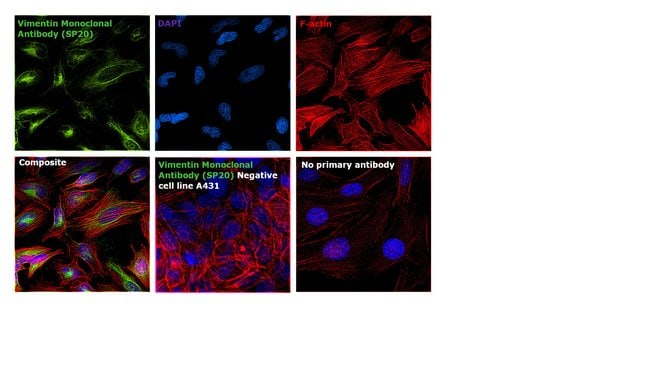 Anti-Vimentin