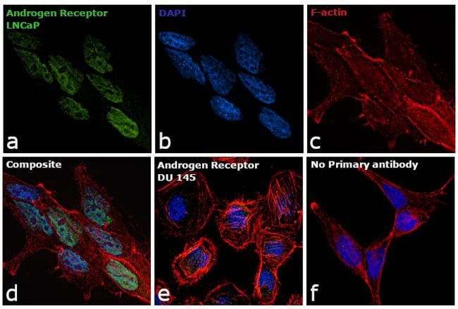 Anti-Androgen Receptor