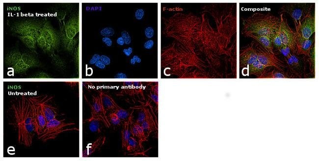 100UG NOS2 Monoclonal Antibody (4E5) hos