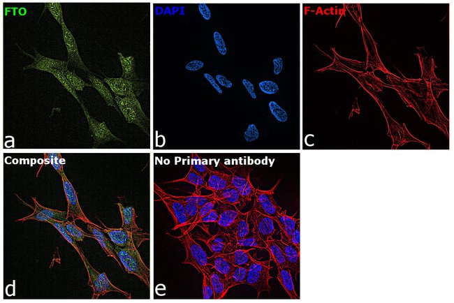 100UL FTO ANTIBODY 100 ul