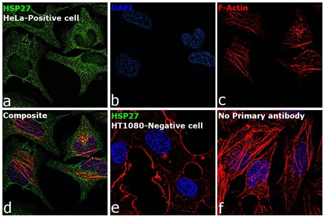 100UL HSP27 ANTIBODY 100 ul
