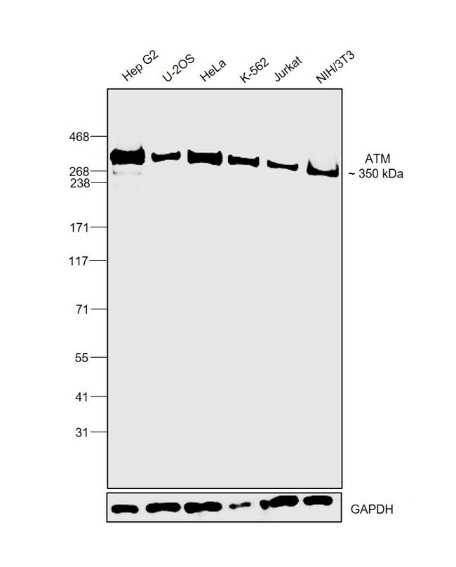 100UL ATM ANTIBODY 100 ul