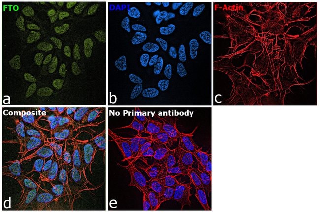 100UL FTO ANTIBODY 100 ul