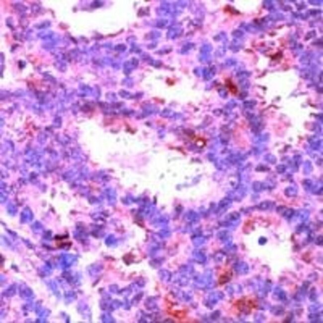 1 ML MAPK1 Rabbit polyclonal antibody Ig