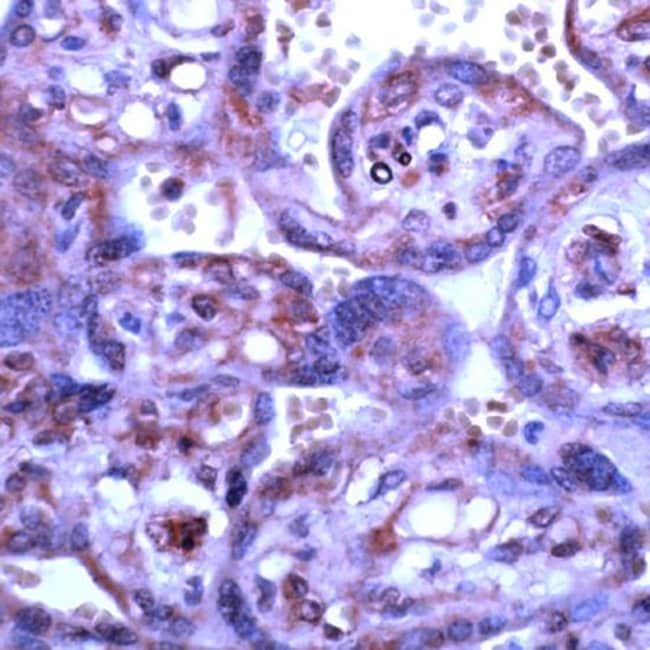 500uL Polyclonal antibody, MMP-15/MT2-MM