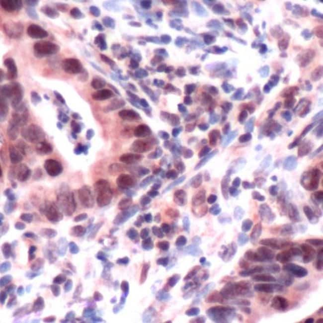 500uL Polyclonal antibody, MSH3, host ra