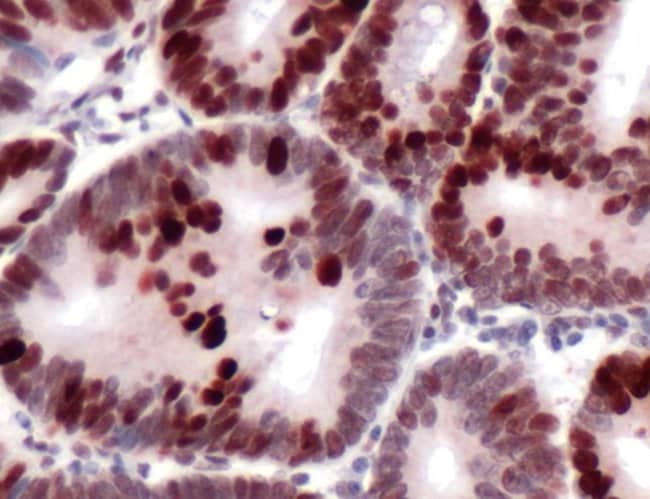 500uL Polyclonal antibody, MSH6, host ra