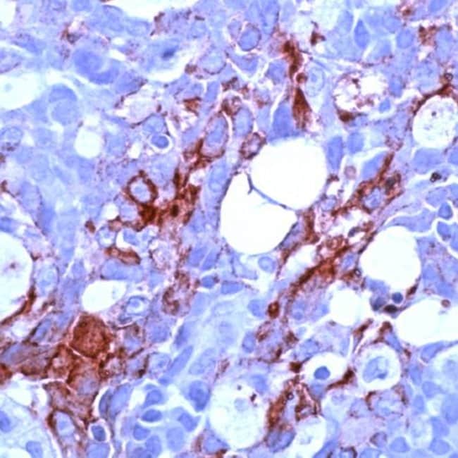 1 ML MUC1 Rabbit polyclonal antibody IgG