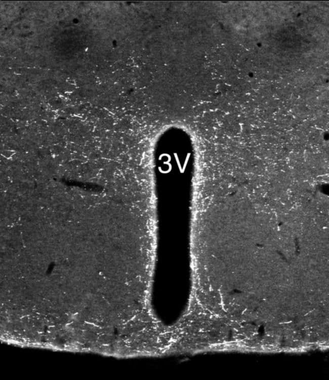 100 UL POLYCLONAL ANTIBODY, ANTI-NEUROPE