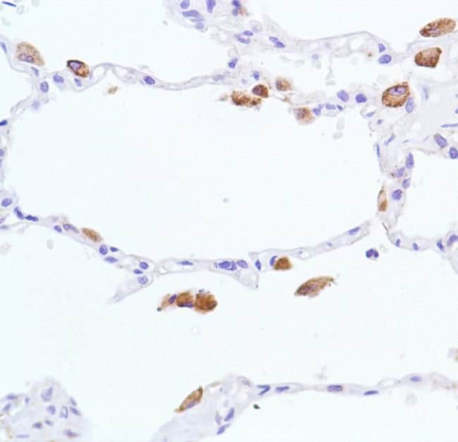 ANTI-NITRIC OXIDE SYNTHASE-INDUCIBLE