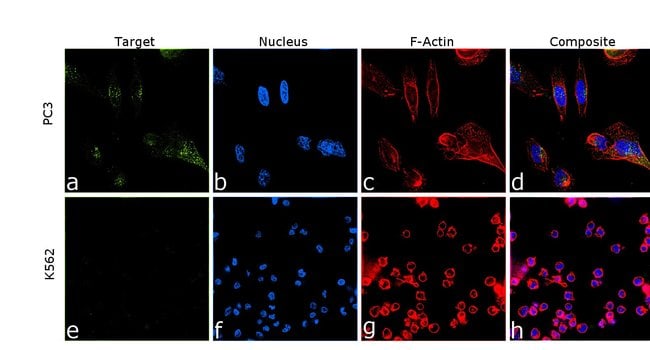 AMYLOID PRECURSOR PROTEIN