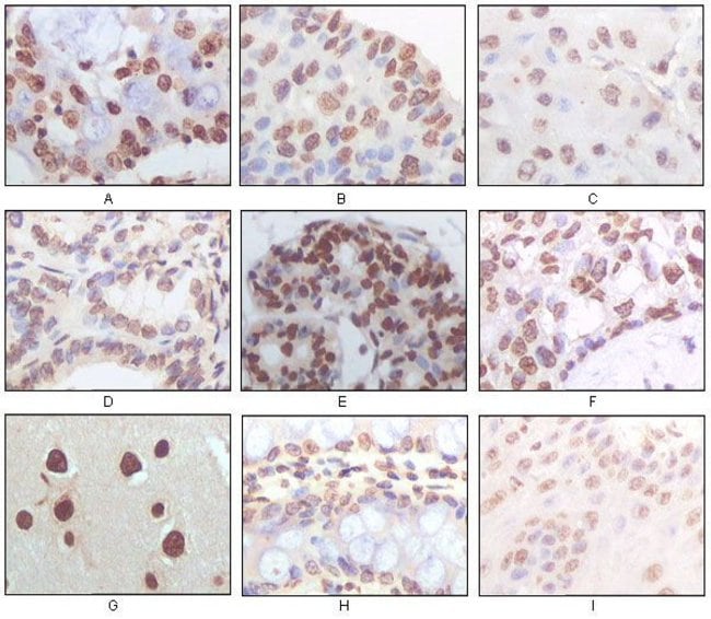 100UL P16 Antibody (5A8A4)