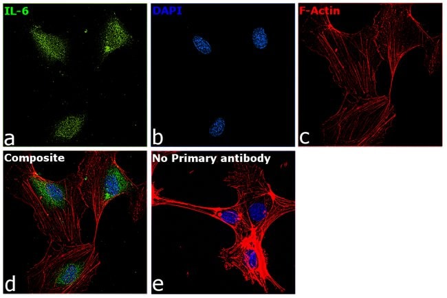 ANTIBODY Human ANALYTE IL-6 ANTIBODY TYP