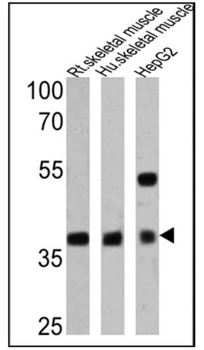 ADIPONECTIN RECEPTOR 1