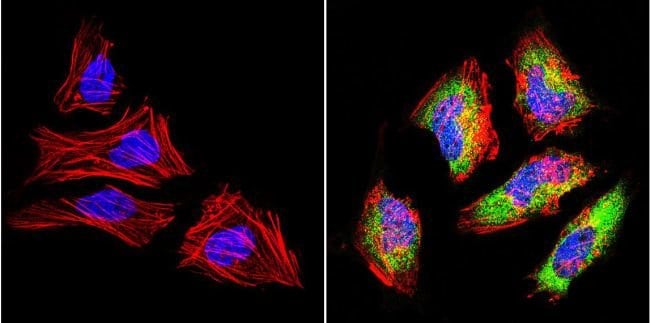 100UG Polyclonal antibody, anti-LIN28, h