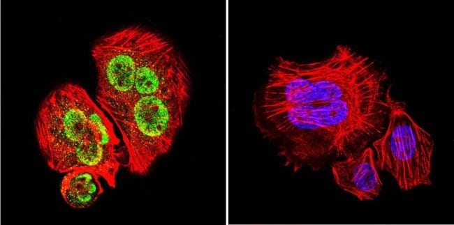 100UG Polyclonal antibody, anti-GATA1, h