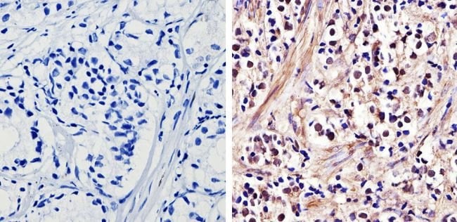 ANDROGEN RECEPTOR