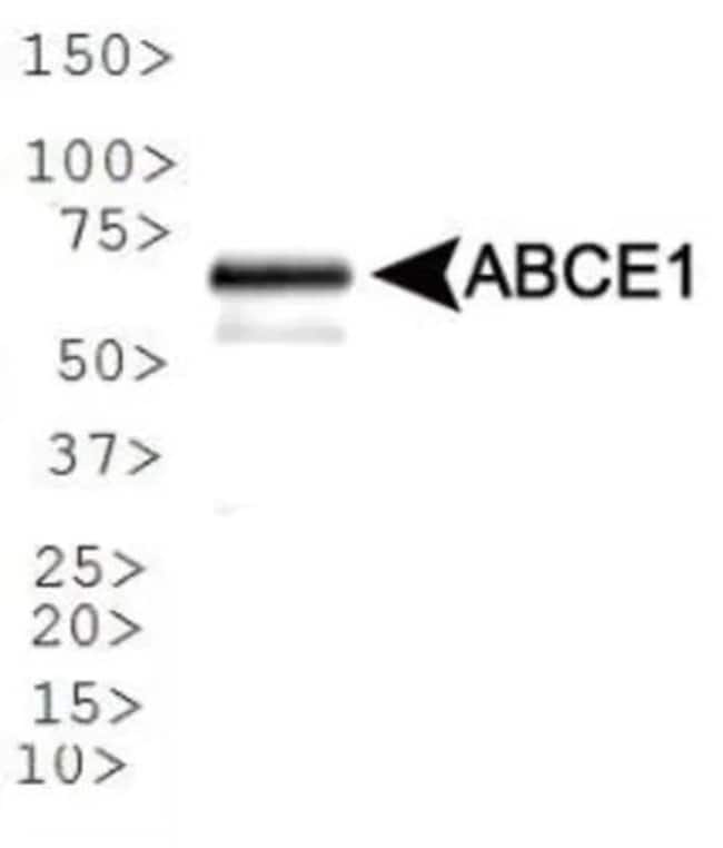 ABCE1