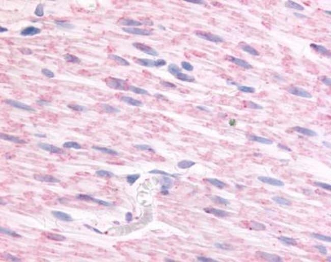 ALPHA-2C ADRENERGIC RECEPTOR