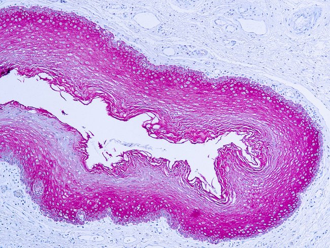 500ul Cytokeratin Pan Polyclonal Antibod