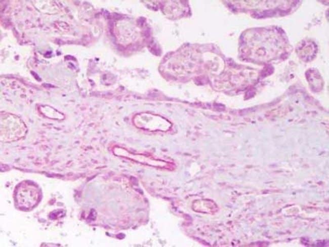 ANGIOPOIETIN 2