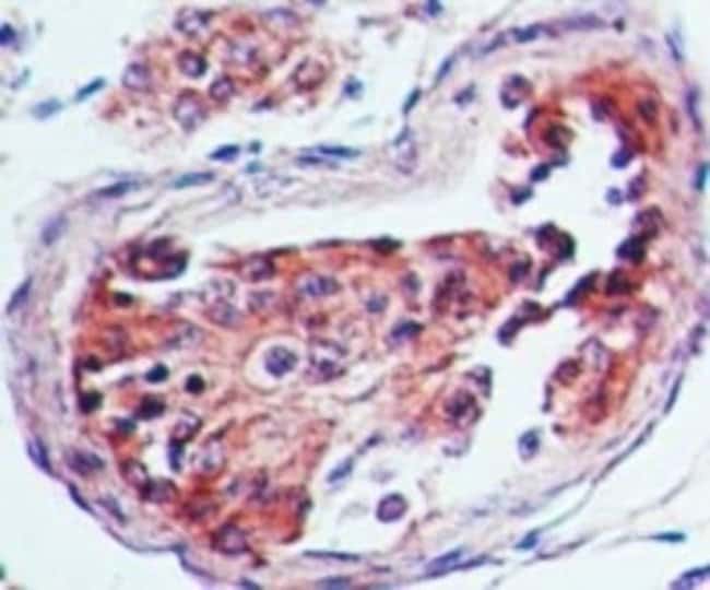 5-HT3 RECEPTOR