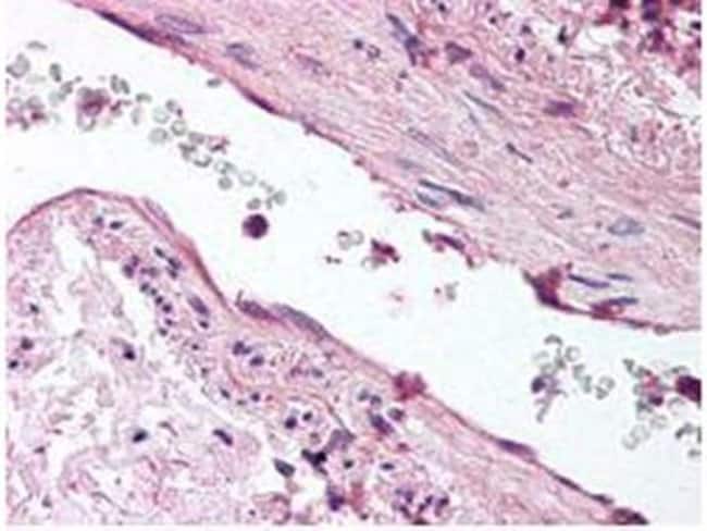 ANGIOPOIETIN 1