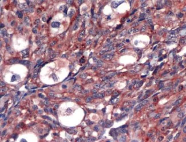 1 ML VEGF Rabbit polyclonal antibody IgG