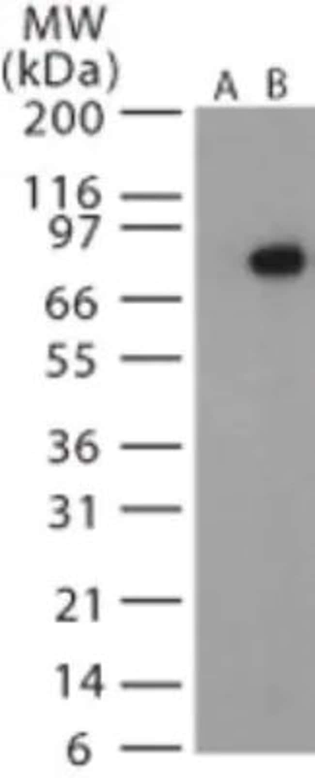 ANTHRAX PROTECTIVE ANTIGEN