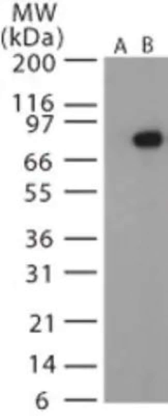 ANTHRAX PROTECTIVE ANTIGEN
