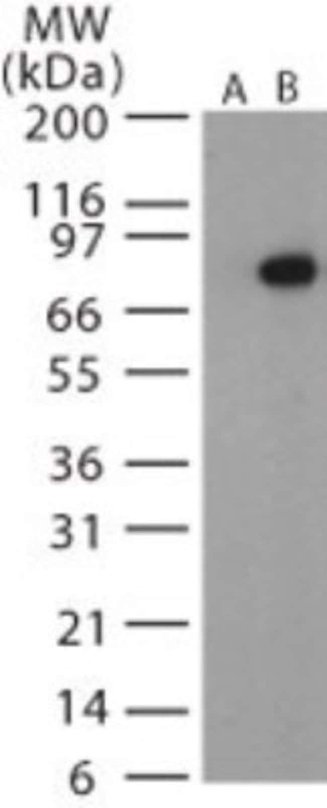 ANTHRAX PROTECTIVE ANTIGEN