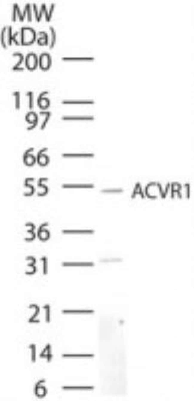 ACTIVIN RECEPTOR TYPE IA