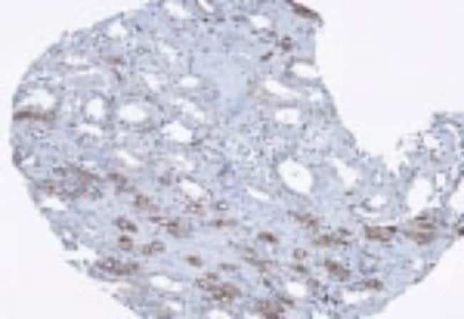 AKAP ASSOCIATED SPERM PROTEIN