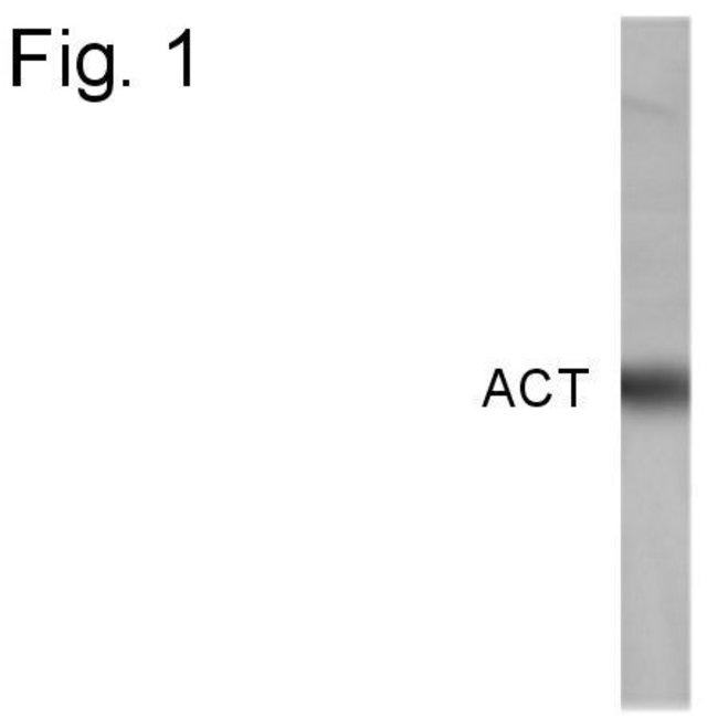 ACT ACT