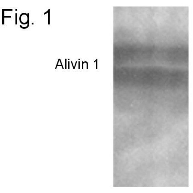 ALIVIN 1