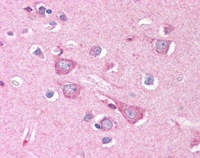 100UL ANTI-DISC1 POLYCLONAL ANTIBODY .