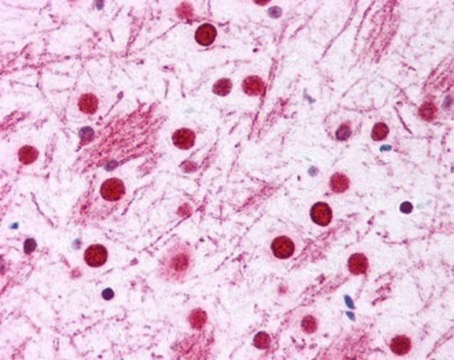 100UL ANTI-DISC1 POLYCLONAL ANTIBODY .