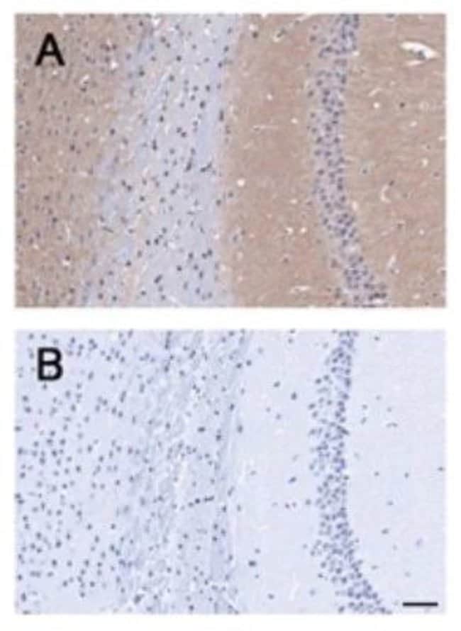 100 UL POLYCLONAL ANTIBODY, ANTI-BAI1, H