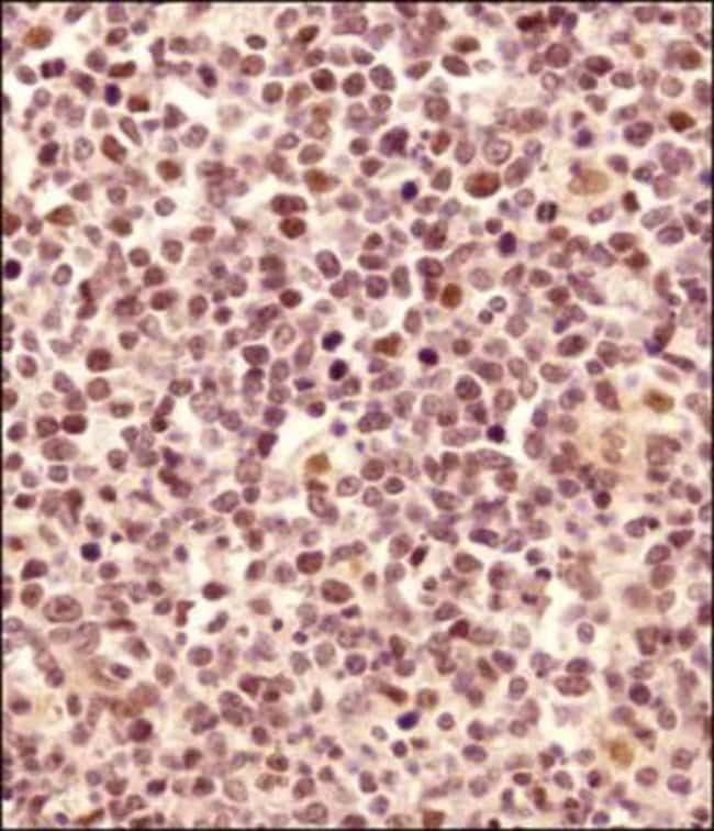 100 UL POLYCLONAL ANTIBODY, ANTI-LMO2, H
