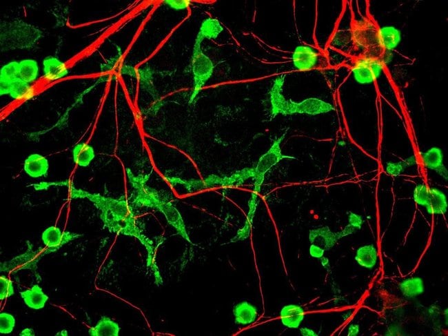 100UL POLYCLONAL ANTIBODY, ANTI-ALPHA-IN
