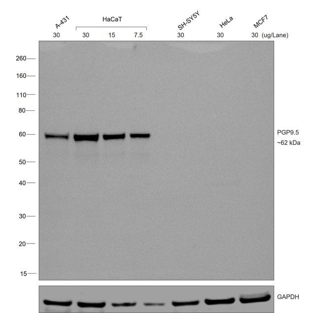 1 ML GOAT ANTI-MOUSE IGG1 SECONDARY ANTI