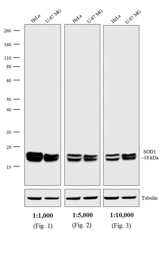 1 MG IgG, IgA, IgM (HRP) Goat polyclonal