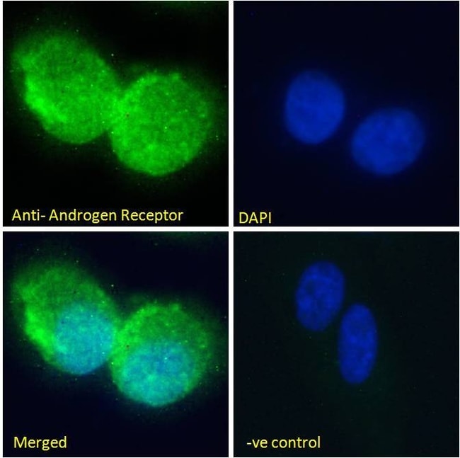 ANDROGEN RECEPTOR