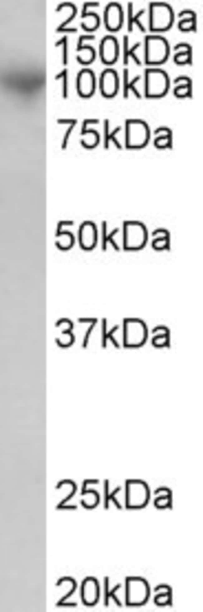 ADAM8