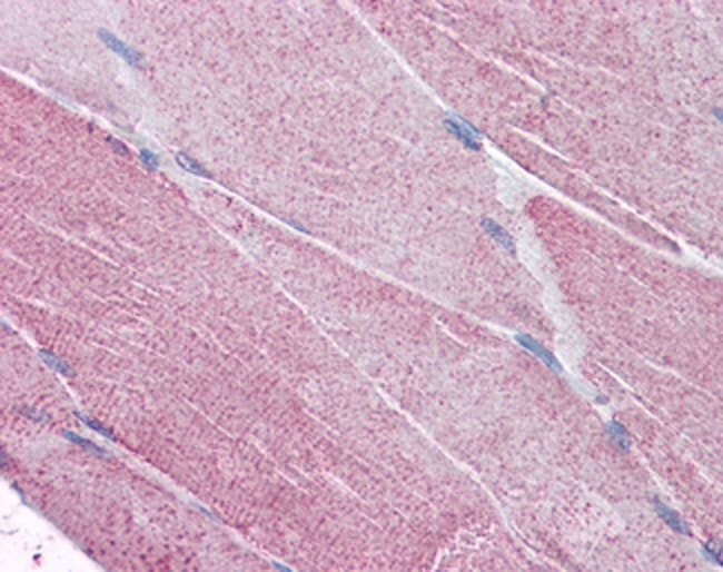 100 UG POLYCLONAL ANTIBODY, ANTI-PCSK6,