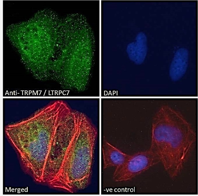 100UG 100 AND POLYCLONAL ANTIBODY, ANTI-