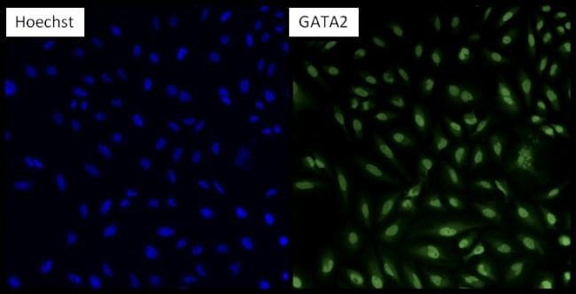 100UG Polyclonal antibody, anti-GATA2, h