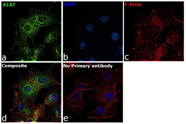 ALPHA-1 ANTITRYPSIN
